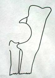 Рис. 14. Схематическое изображение art. cubiti. Визуализируется ступенька, - дисконгруэнтность суставных поверхностей сочленяющихся костей.